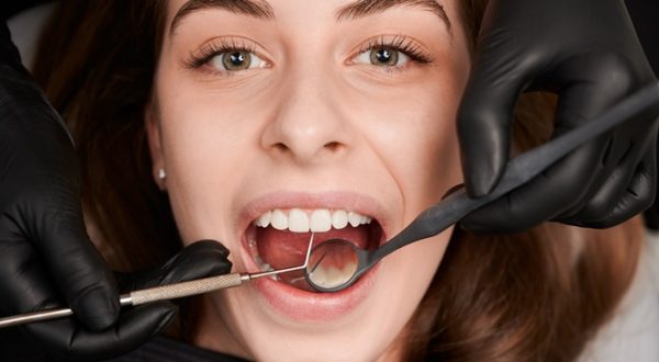 Parodontitis – banalna ili ozbiljna stvar?